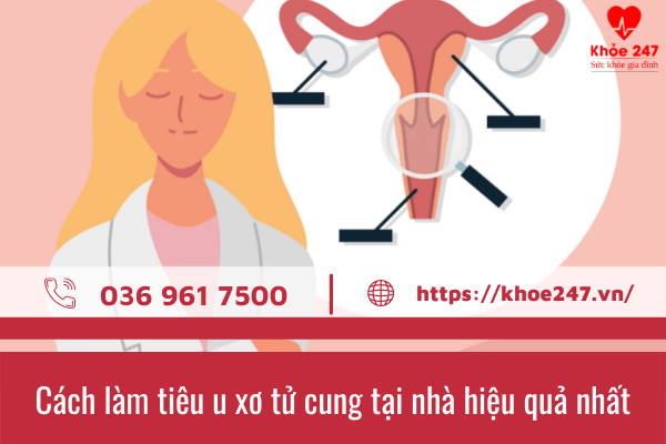 cách làm tiêu u xơ tử cung