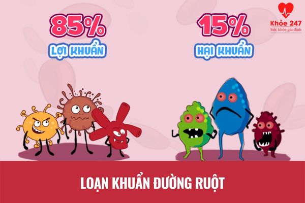 Chướng bụng đầy hơi do loạn khuẩn đường ruột