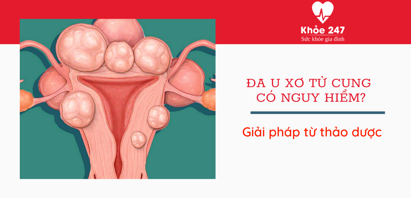 Đa u xơ tử cung