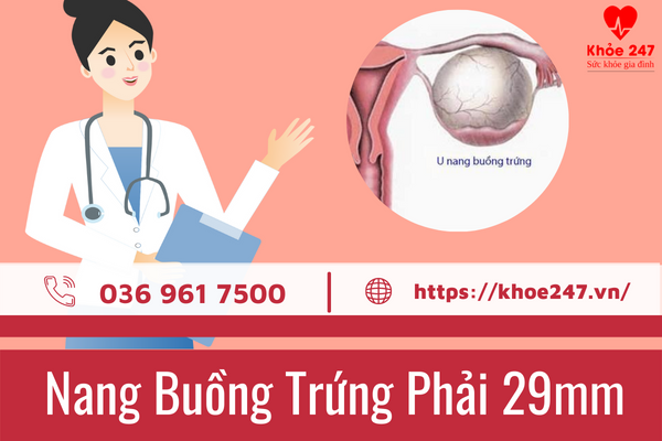 Nang buồng trứng phải 29mm