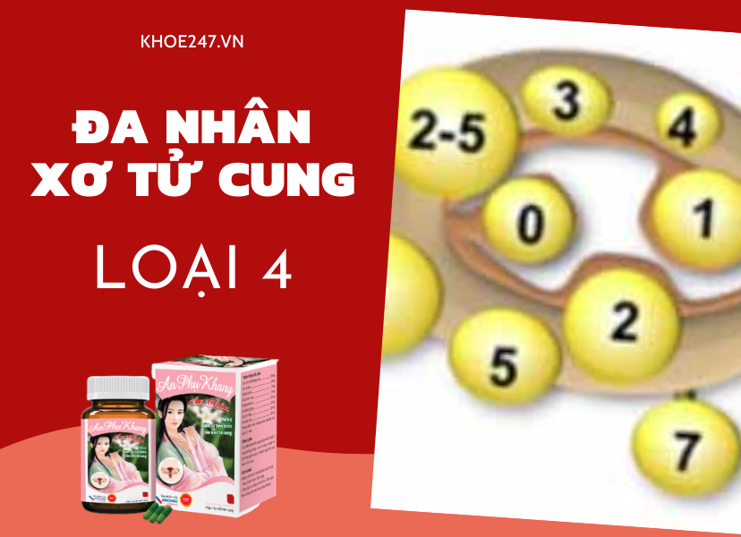 Nhân xơ tử cung loại 4