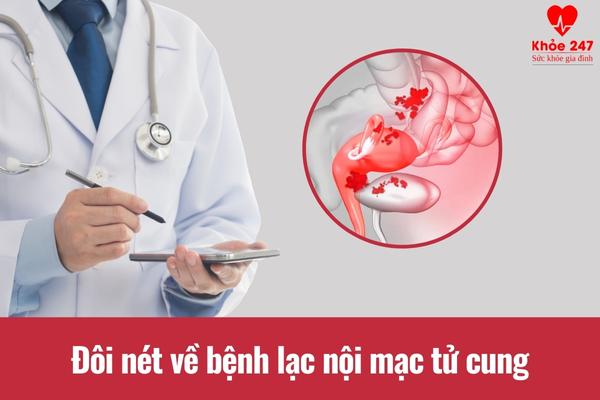 Đôi nét về bệnh lạc nội mạc tử cung