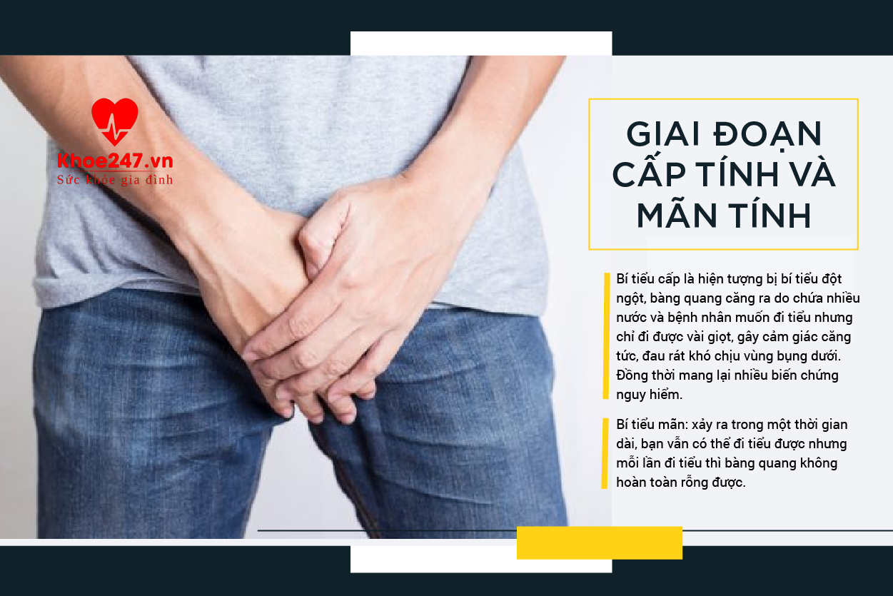 Bí tiểu cấp và mãn tính