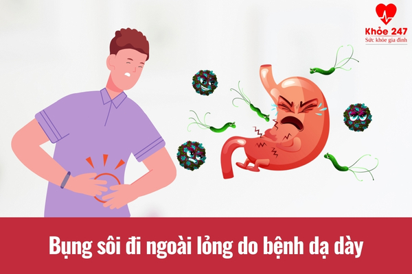 Bụng sôi đi ngoài lỏng do bệnh dạ dày