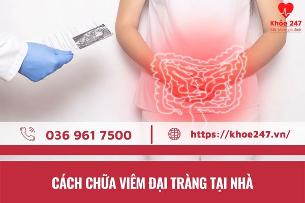 Cách chữa viêm đại tràng tại nhà