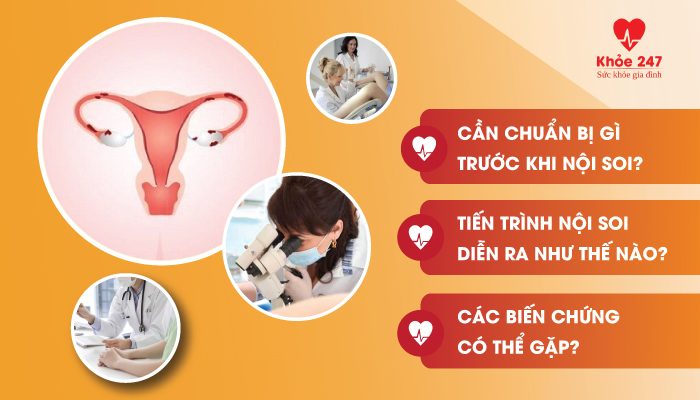 Cần chuẩn bị gì trước khi nội soi tử cung
