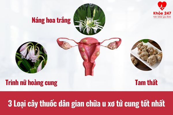 Tìm hiểu 2 cây thuốc dân gian chữa u xơ tử cung hiệu quả