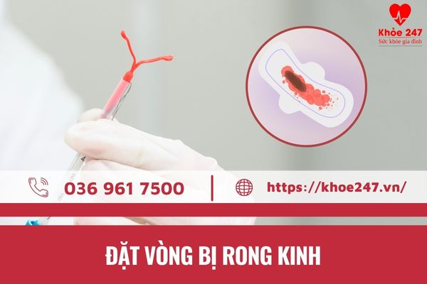 Nhiều chị em gặp tình trạng rong kinh sau khi đặt vòng tránh thai