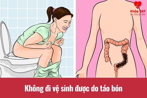 Không đi đại tiện được do táo bón