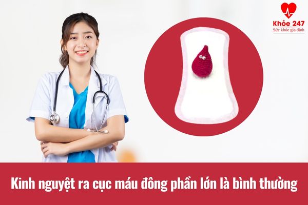 Phần lớn các trường hợp kinh nguyệt ra cục máu đông là bình thường