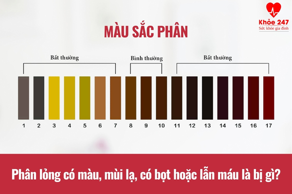 Đặc điểm của phân có thể là dấu hiệu cảnh báo bệnh lý