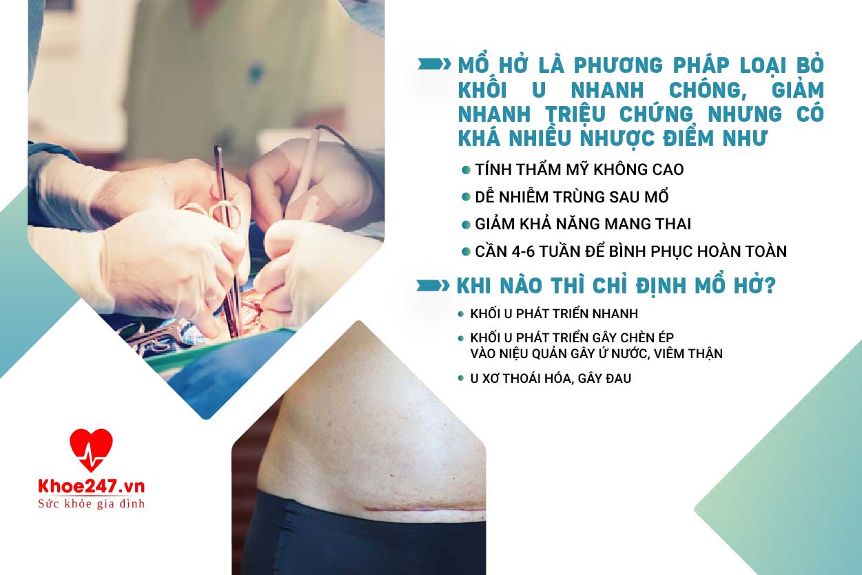 Mổ hở U xơ tử cung