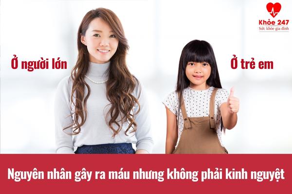 Tìm hiểu nguyên nhân gây tình trạng ra máu nhưng không phải kinh nguyệt