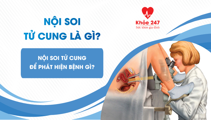 Nội soi tử cung là gì