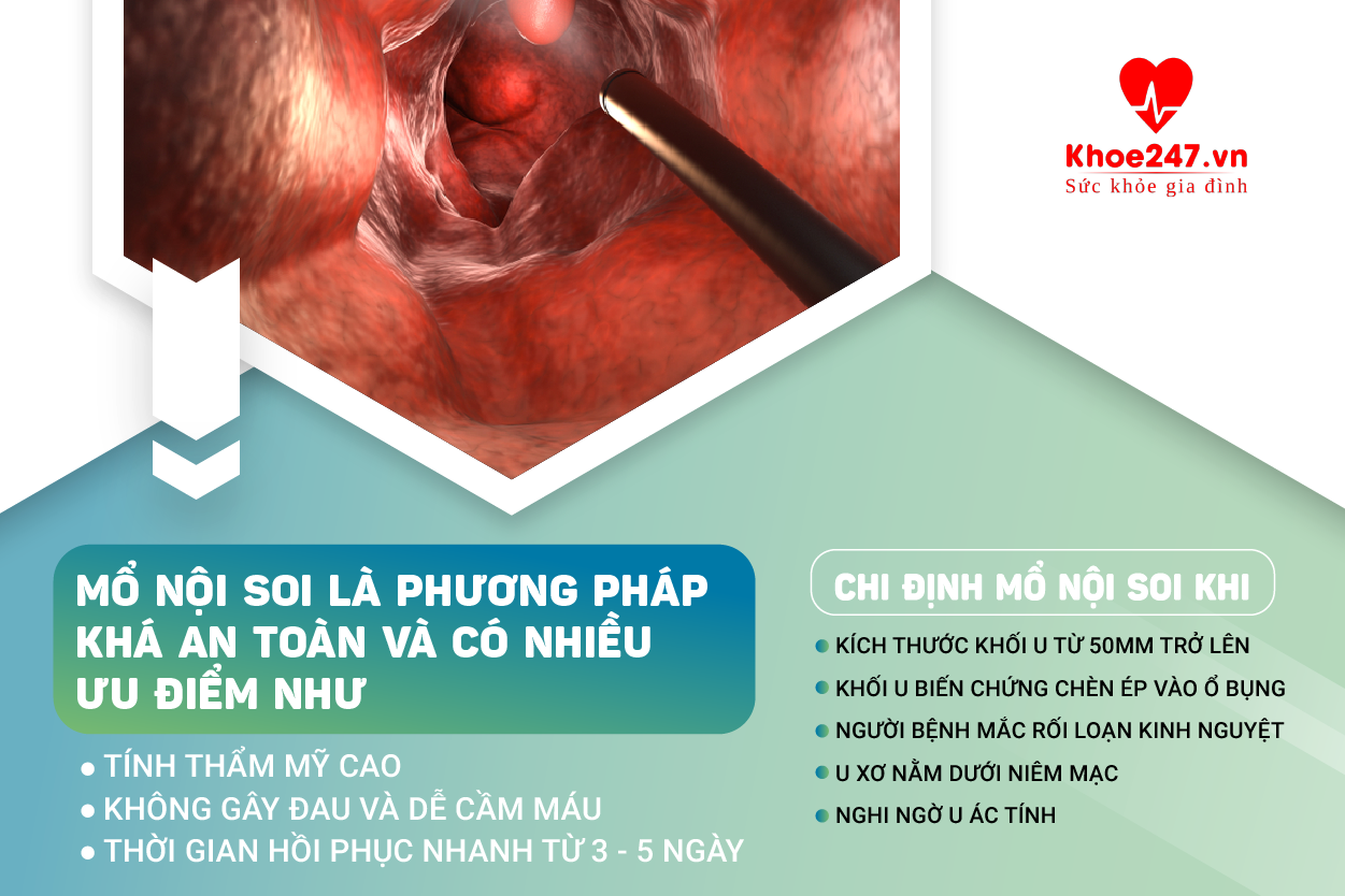 Mổ nội soi u xơ tử cung