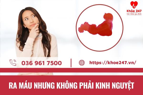 Nhiều chị em có tình trạng ra máu kinh nhưng không phải trong thời kỳ kinh nguyệt