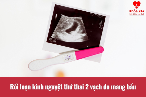 Rối loạn kinh nguyệt thử thai 2 vạch có thể là dấu hiệu mang thai