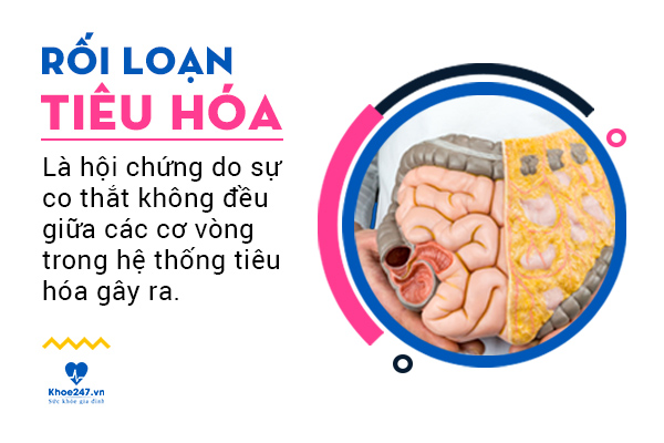 Rối loạn tiêu hóa là chứng bệnh thường gặp ở nhiều lứa tuổi.