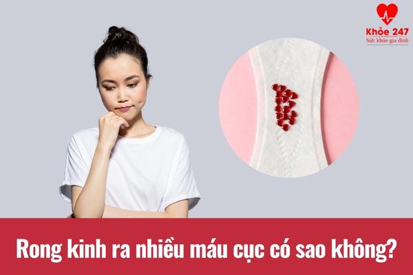 Chị em không nên chủ quan, xem nhẹ hiện tượng rong kinh ra nhiều máu cục