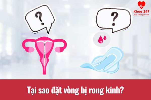 Tìm hiểu nguyên nhân dẫn tới tình trạng rong kinh khi đặt vòng tránh thai