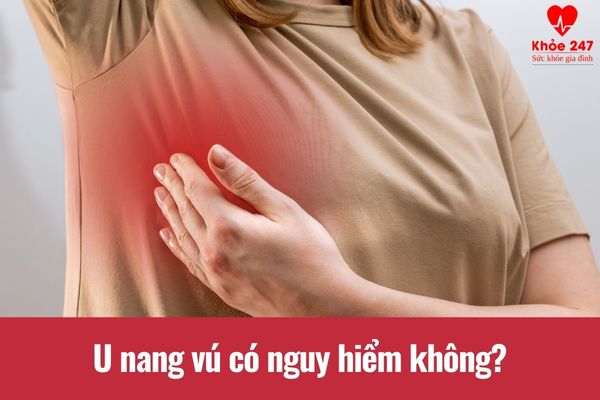 Đa số các trường hợp mắc u nang vú thường không nguy hiểm