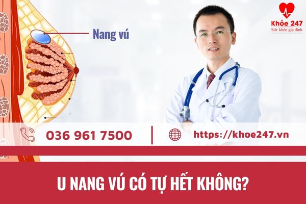 Nhiều chị em băn khoăn không biết u nang vú có tự hết không