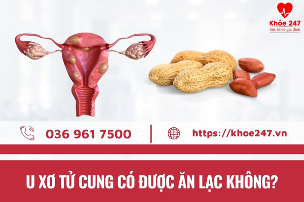 Nhiều chị em băn khoăn không biết u xơ tử cung có ăn được lạc không