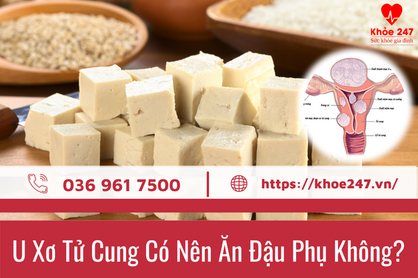 U Xơ Tử Cung Có Nên Ăn Đậu Phụ