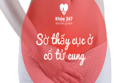 U xo tử cung có thể dẫn đến tình trạng sờ thấy cục ở cổ tử cung không?
